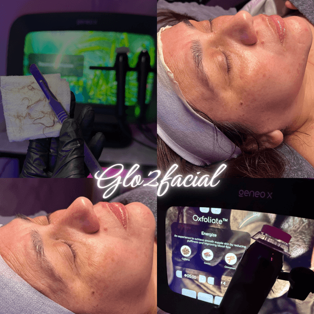 GLO2FACIAL 3 PACK